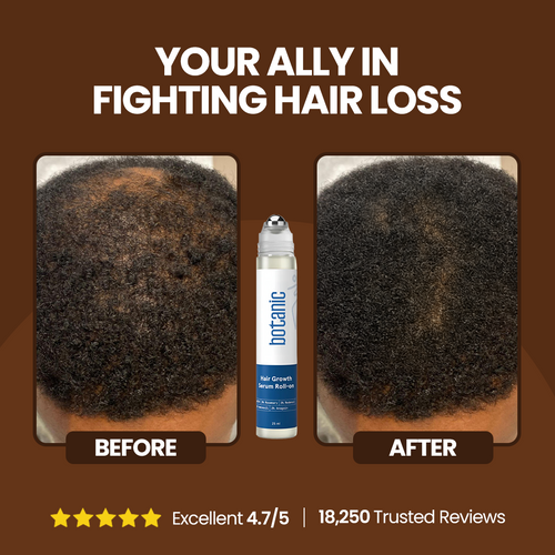 Botanic Hair Growth Roll-On